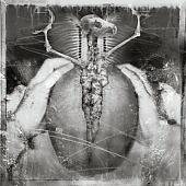 Nerve Damage