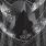 Otus - Death Throes