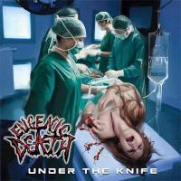 Under the Knife