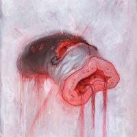 Prolapse